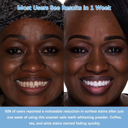 🔥Maximum Whitening Bundle - Teeth Whitening Powder & Vegan Powder - Peroxide-Free, Removes Stains - Daily Brightening Formula - 3-Month Supply