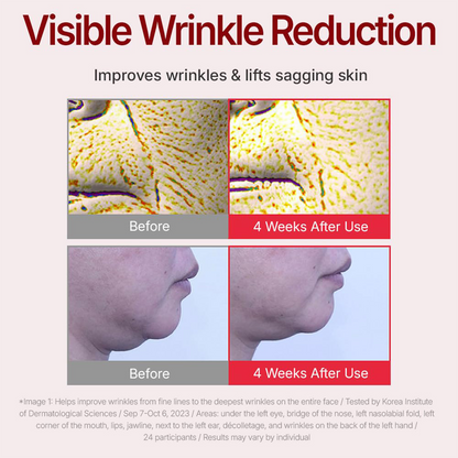 🔥Sale Happening Now:70%OFF-Time Reverse | Anti-Aging Moisturizer for Wrinkles & Dry Skin